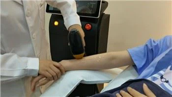 Lazerli diodli optik tolali epilasyon mashinasi