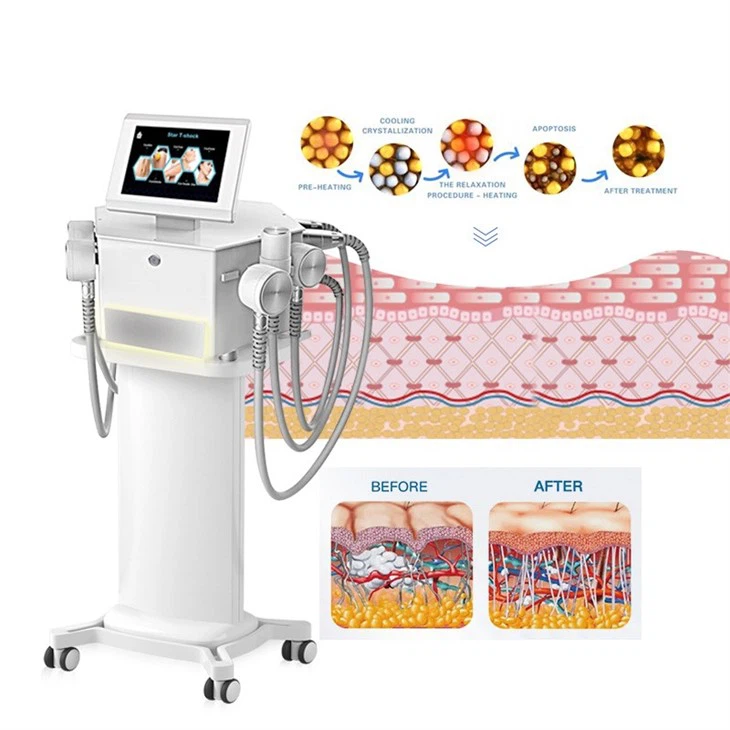 Cryotoning And Cryoslimming Machine