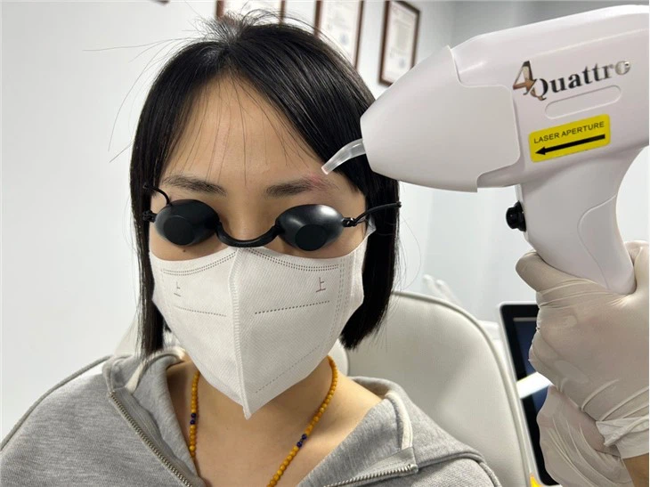 High Energy Diode Laser Hair Removal