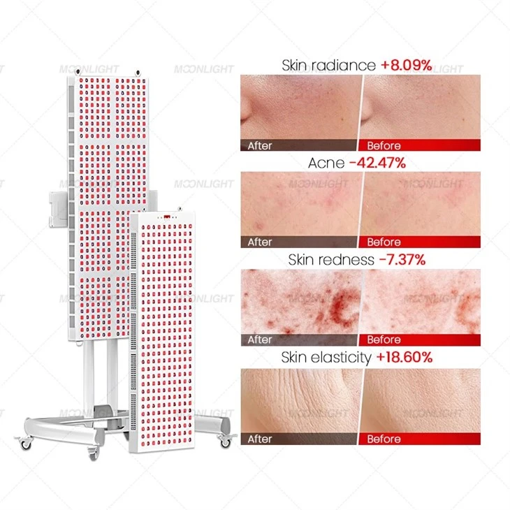 Factory Price Red Light Therapy Panel