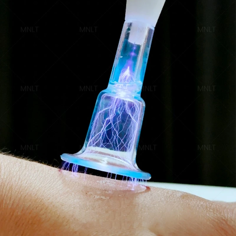Hot & Cold Plasma Machine – Next-Gen Skin Rejuvenation Technology factory
